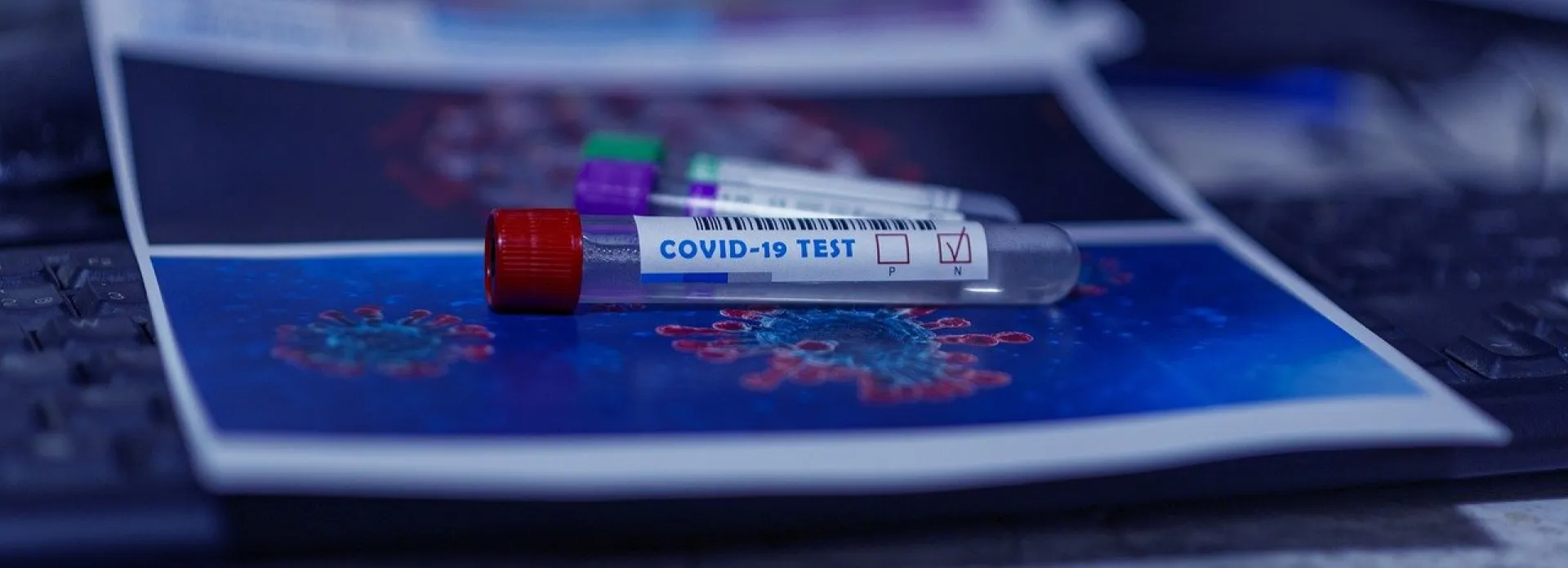 475 новых случаев заболевания COVID-19 выявили за прошедшие сутки в Алтайском крае 475 новых случаев заболевания COVID-19 выявили за прошедшие сутки в Алтайском крае