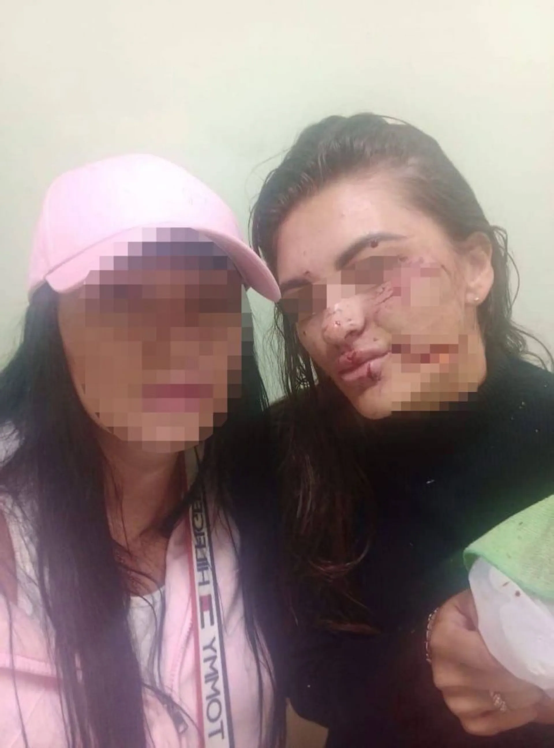 Бийчанину, изуродовавшему девушку ударом бокала, предъявили обвинение Бийчанину, изуродовавшему девушку ударом бокала, предъявили обвинение