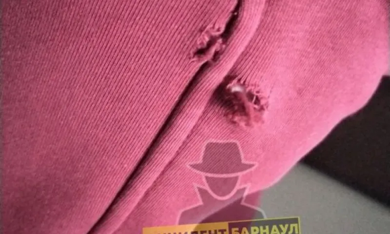 Бездомная собака покусала жительницу Барнаула 
