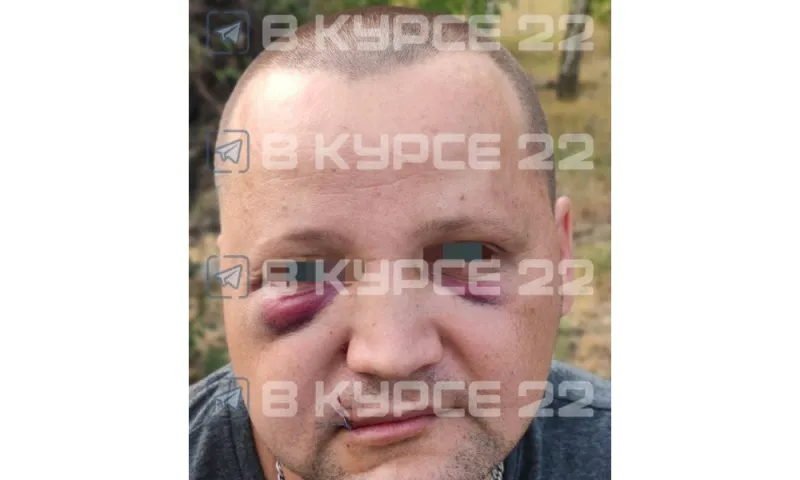 Фельдшера скорой помощи жестоко избили в Яровом