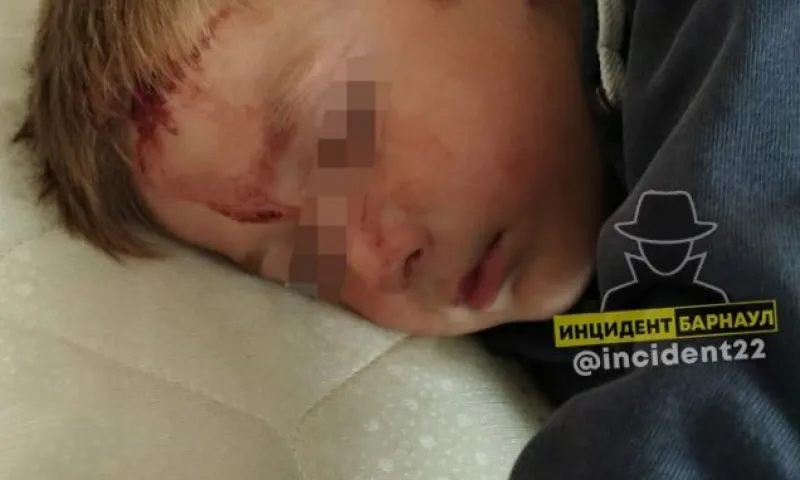 Соцсети: 5-летнего ребенка серьезно избили на детской площадке в Барнауле