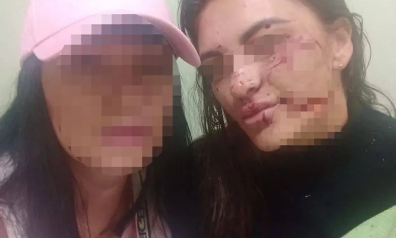 Бийчанину, изуродовавшему девушку ударом бокала, предъявили обвинение