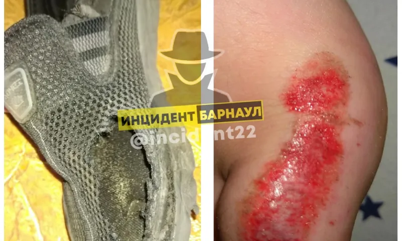 В Барнауле автомобиль проехал по ноге ребёнка