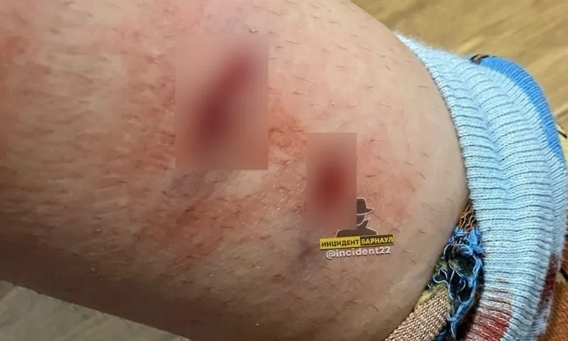 Бездомные собаки покусали жительницу Барнаула